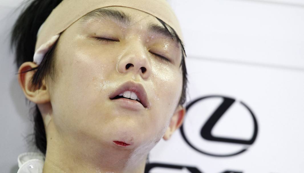 Hanuy dopo l’esecuzione del programma del libero. Ben visibili il taglio e la fasciatura sulla testa. REUTERS